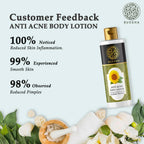 Buddha Natural Anti Acne Body Lotion - For Help Clear Acne & Future Breakouts | Grocsy