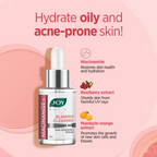 Joy Skin Renewing Niacinamide Face Serum For Clearing Skin Blemishes & UV Protection | Grocsy