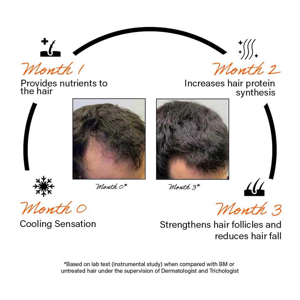 Rootcos Caffeine Hair Fall Control Serum | Grocsy
