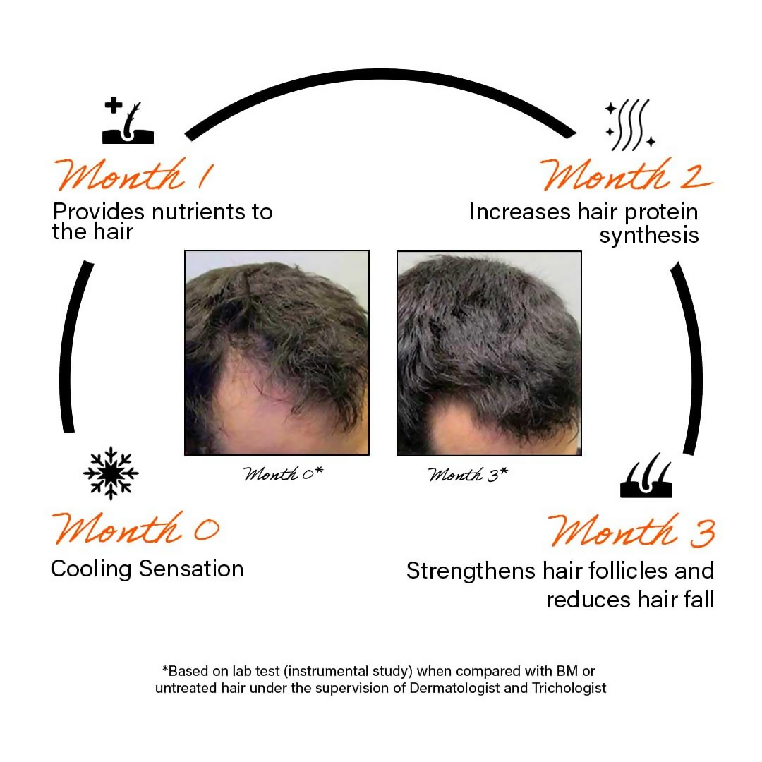 Rootcos Caffeine Hair Fall Control Serum | Grocsy