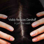 Kapiva Ayurveda Hair Rituals Neem Triphaladi Shampoo for Dandruff Control | Grocsy