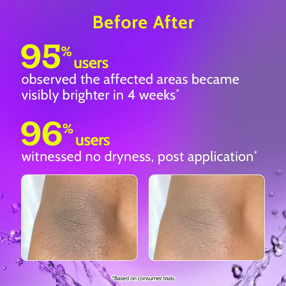 Chemist at Play Vitamin C Neck Knee Elbow Brightening Roll On for Men & Women | Grocsy