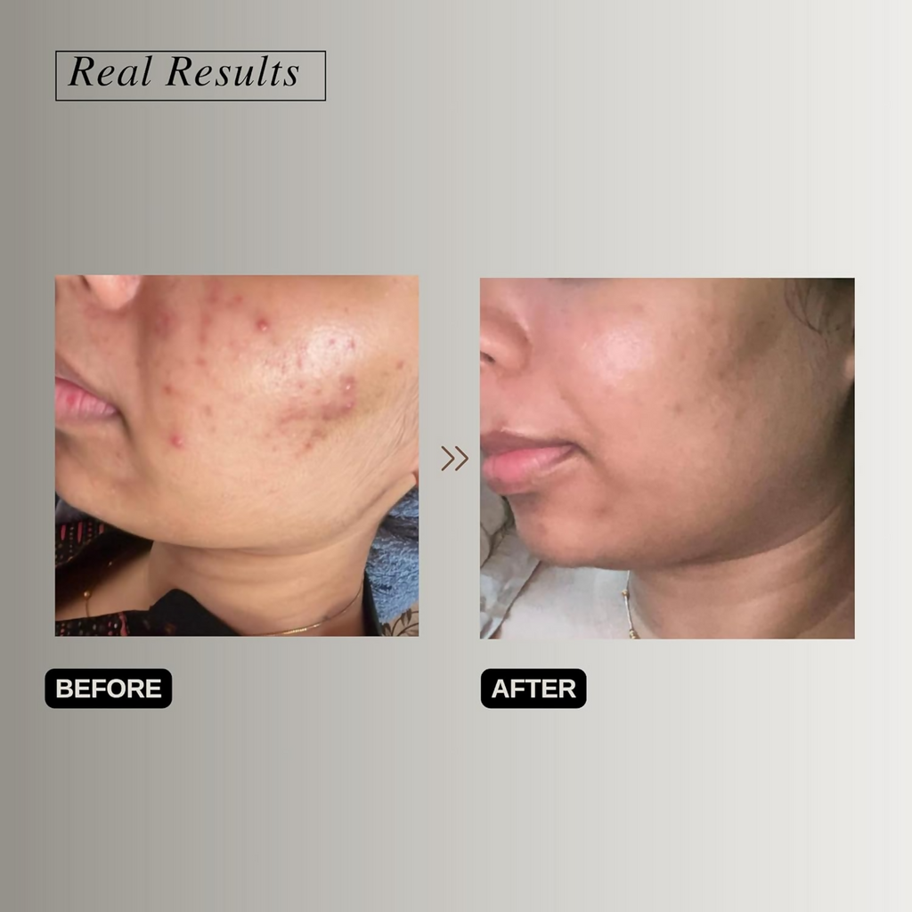 The Formularx Hydra Veil Malazia Hyaluronic Acid Gel Moisturizer | Grocsy