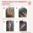 Ivory Natural Dandruff Hair Mist For Flake-Free Confidence And Silky Smooth Hair | Grocsy