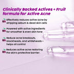 PLIX The Plant Fix 2% Salicylic Acid Jamun Active Acne Control Dewy Serum For Active Acne & Dark Spot Reduction | Grocsy