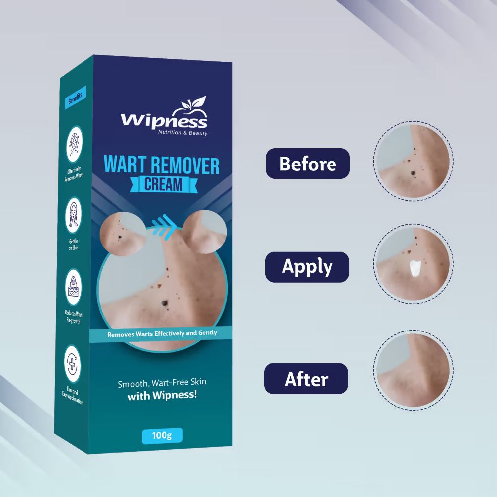 Wipness Natural Wart Remover Cream For Men & Women | Grocsy