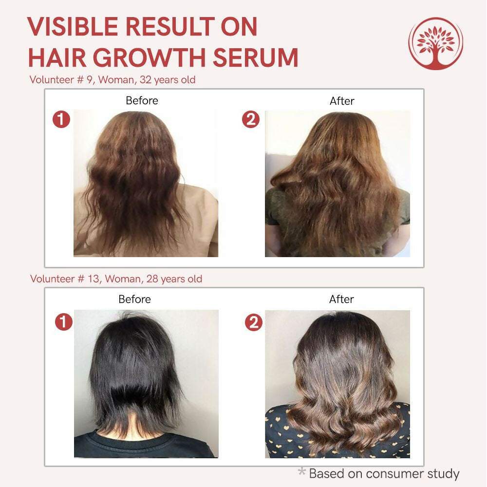 Ivory Natural Serum For Growth Of Hair For New Hair Roots & Encouraging Growth Of Hair | Grocsy