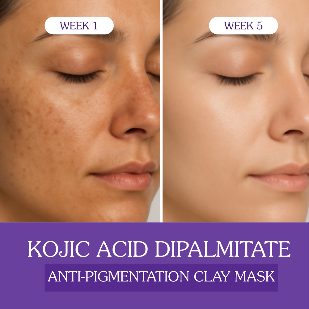 Bake Kojic Acid Anti-Pigmentation Clay Mask | Grocsy