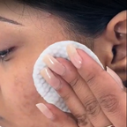 House of Beauty Anti Pimple Wipes | Grocsy