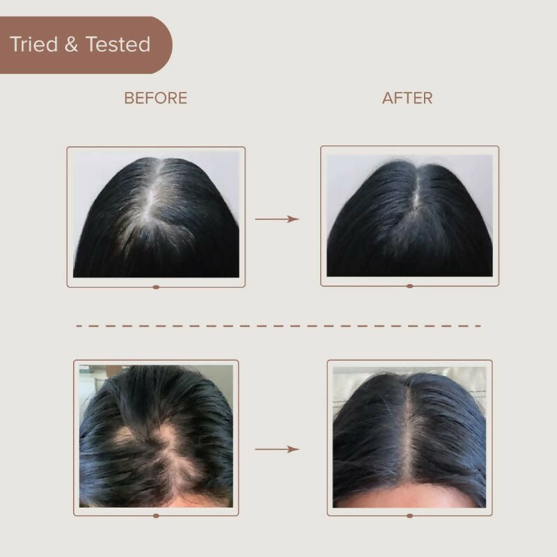 Dromen & Co Ayurvedic Hair Brew Oil With Fusion Of 15 Herbs | Grocsy
