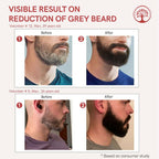 Ivory Natural Greys Beard Serum Restore Natural Black Color Of Grey White Beard | Grocsy
