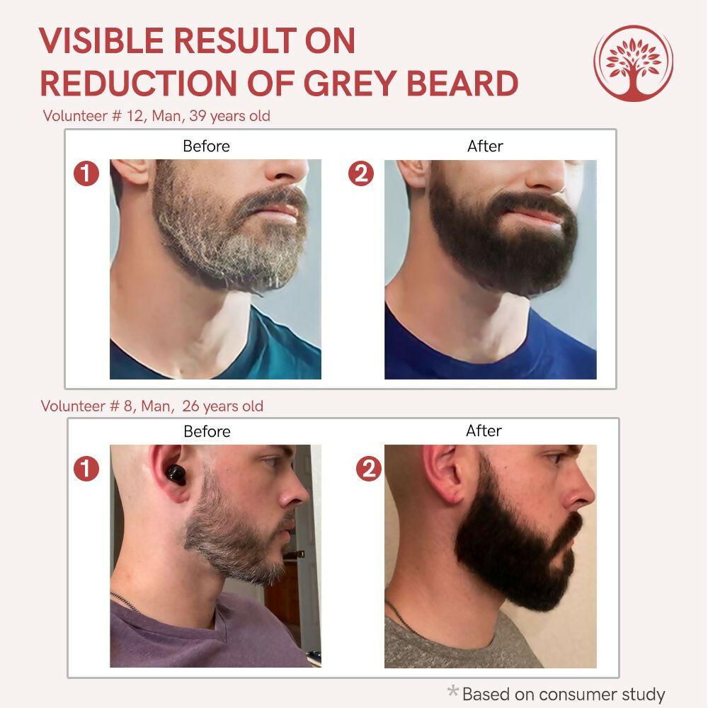 Ivory Natural Greys Beard Serum Restore Natural Black Color Of Grey White Beard | Grocsy