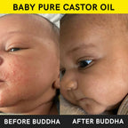 Buddha Natural Baby Castor Oil Cold Pressed Extra Virgin | Grocsy