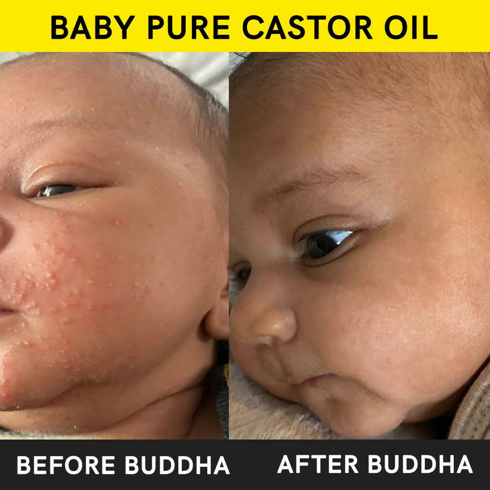 Buddha Natural Baby Castor Oil Cold Pressed Extra Virgin | Grocsy