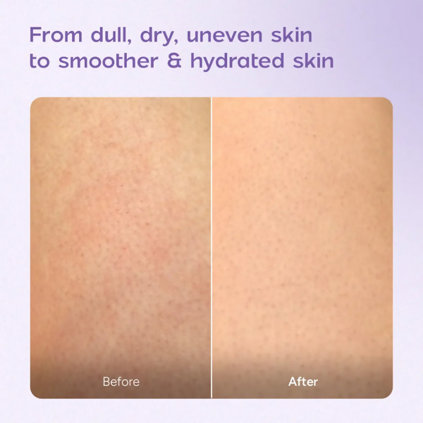 Arata Niacinamide Body Milk for Dull and Dehydrated Skin | Grocsy