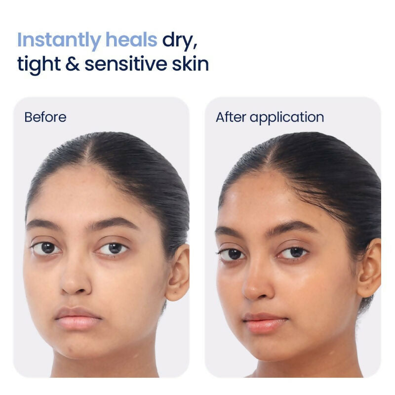 Wishcare 3:1:1 Barrier Bounce Moisturizer with Non-Comedogenic | Grocsy
