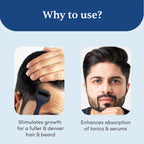 Man Matters Advance Derma Roller For Hair & Beard - 540 Micro 0.5mm Titanium Alloy Needles | Grocsy