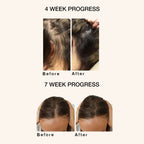Skog Super Hair Repair | Grocsy
