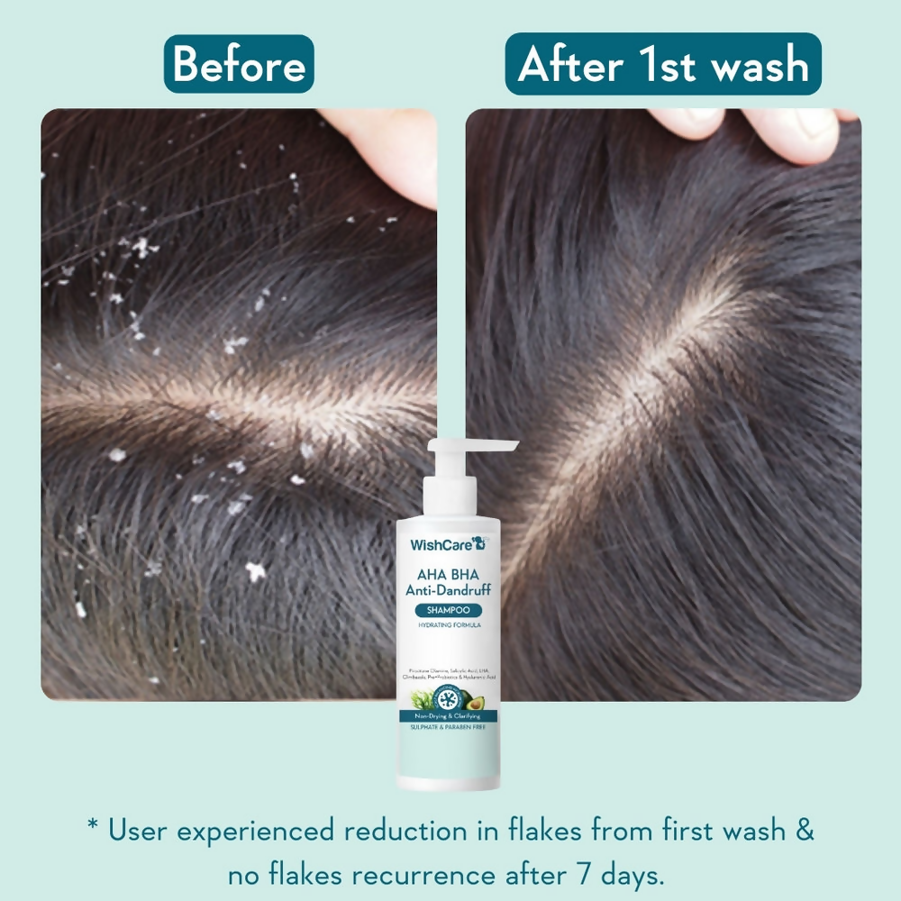 WishCare Aha Bha Anti-Dandruff Shampoo | Grocsy