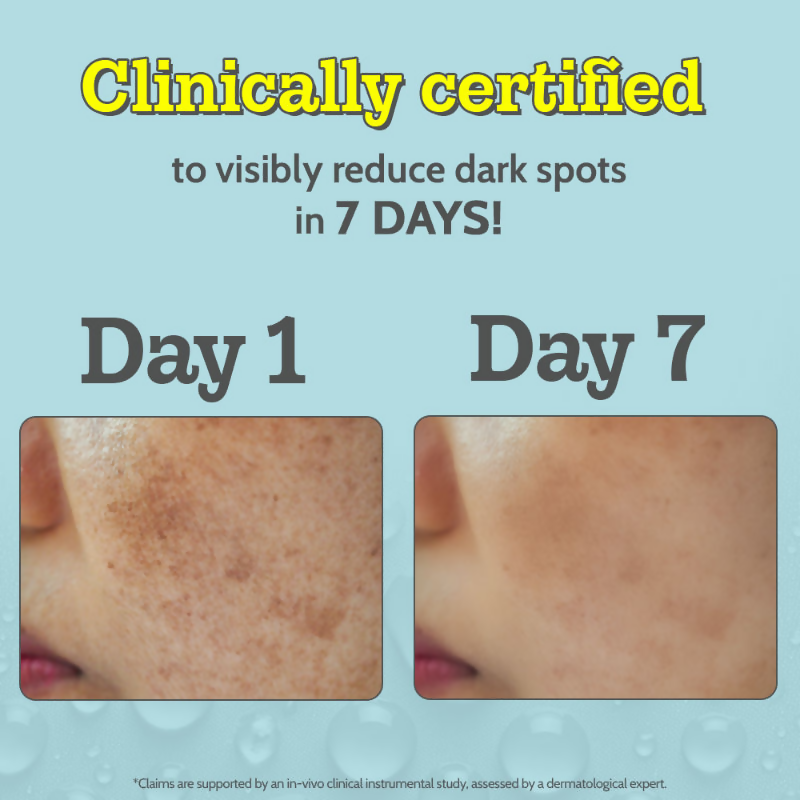 Chemist At Play 10% Vitamin C Face Serum | Grocsy