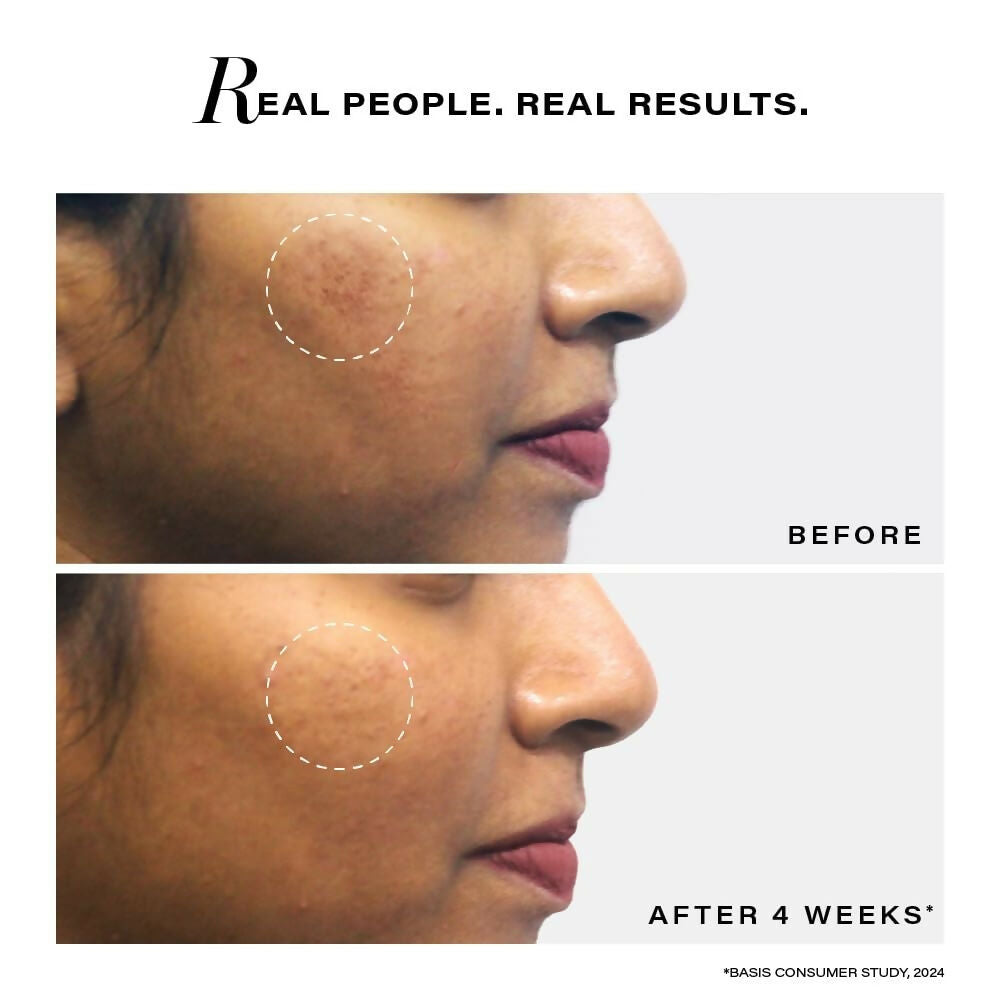 Novology Pigmentation Reduction Serum For Dark Spots | Grocsy