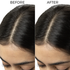 Brillare Dandruff Control Kit | Grocsy