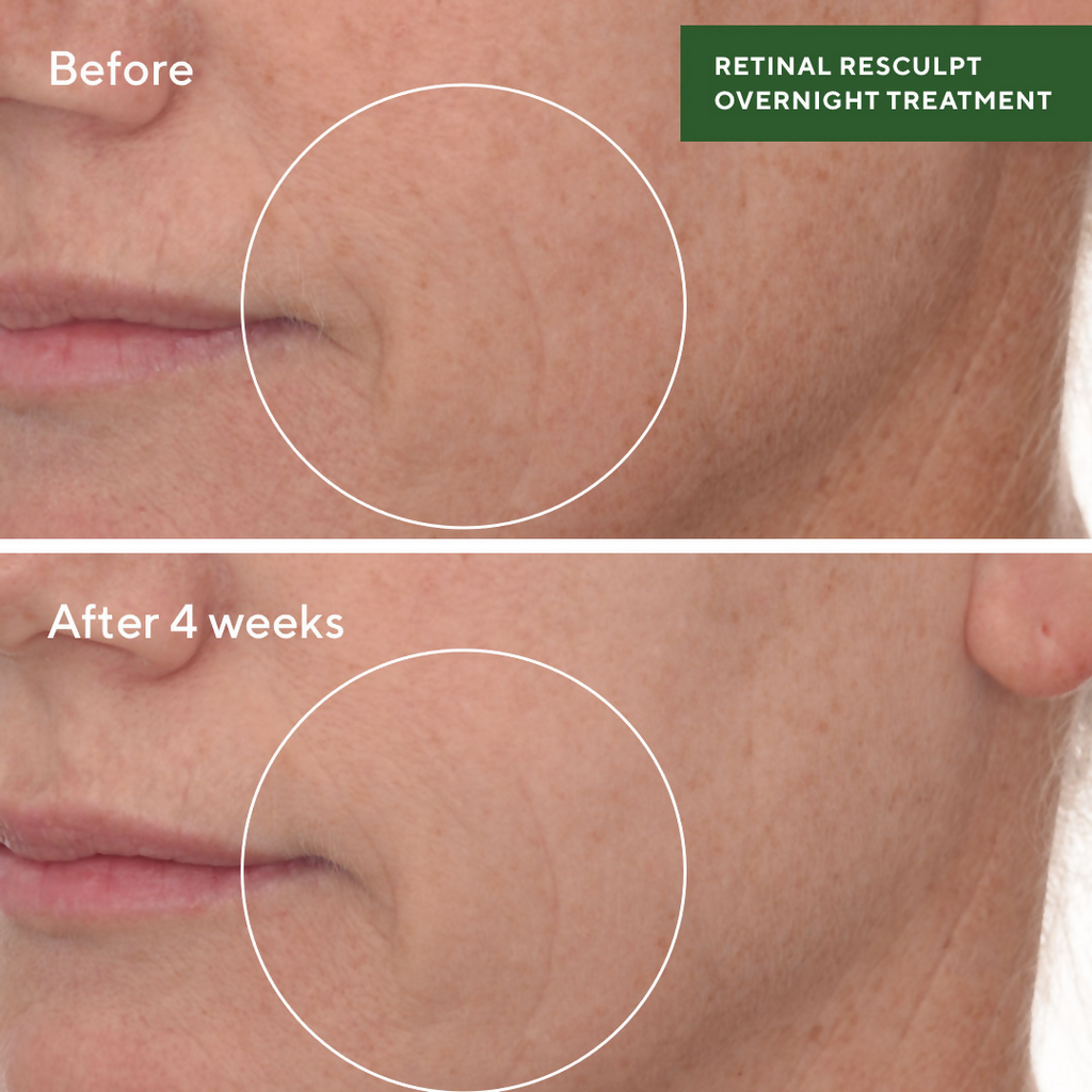 Murad Retinal ReSculpt Overnight Treatment | Grocsy