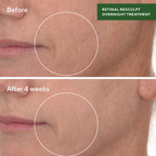 Murad Retinal ReSculpt Overnight Treatment | Grocsy