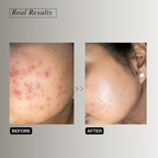 The Formularx Barrier Relief Ceramide Lightweight Moisturizer With Niacinamide & Hyaluronic Acid | Grocsy
