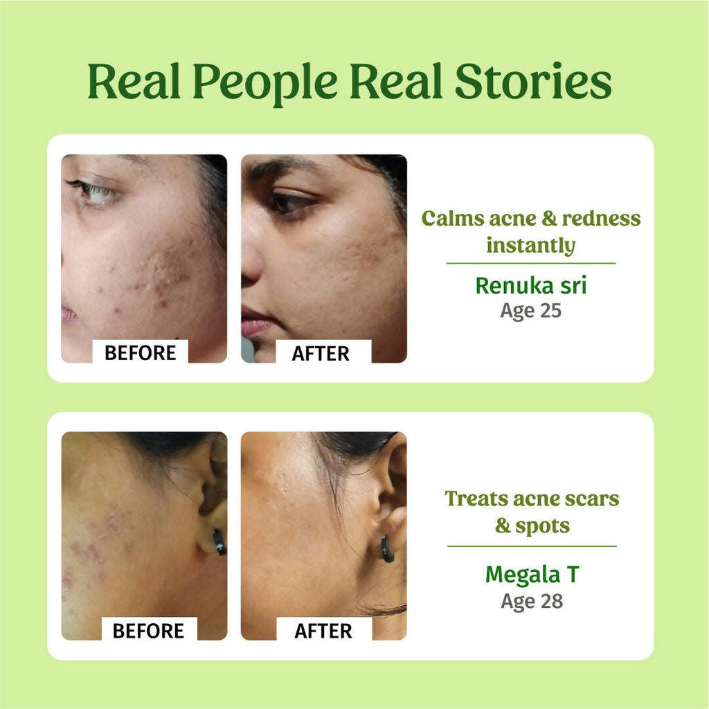 Vilvah Store Aloe Vera Gel (Multi-Purpose Skin & Hair Care) | Grocsy