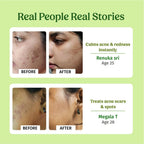 Vilvah Store Aloe Vera Gel (Multi-Purpose Skin & Hair Care) | Grocsy