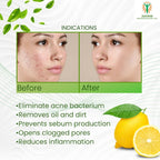 Adonis DS Acne Facewash | Grocsy
