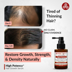 Derma Global High Potency Hair Growth Serum | Grocsy