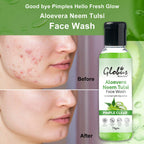 Globus Remedies Aloe vera Neem Tulsi Enriched With Glycerin & Oil Control Formula | Grocsy