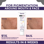 Sanfe Brighten & Repair Spotlite Pigmentation Lightening Cream | Grocsy