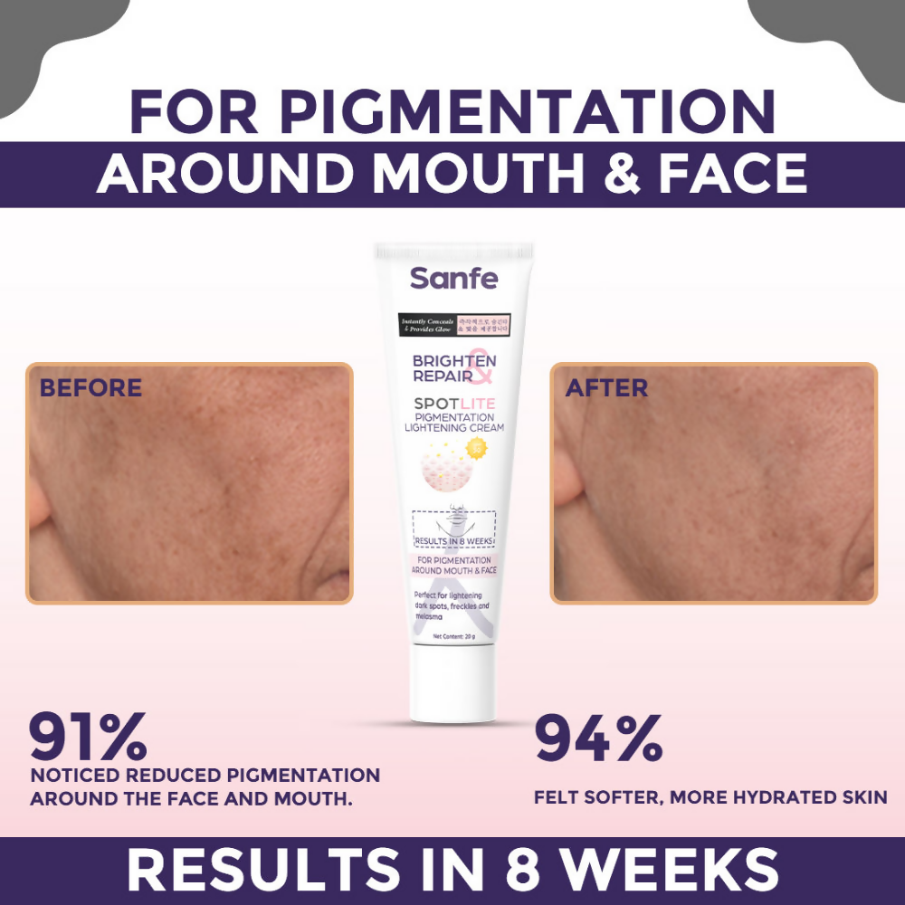 Sanfe Brighten & Repair Spotlite Pigmentation Lightening Cream | Grocsy