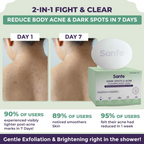 Sanfe Dark Spots & Acne Clearing Body Soap | Grocsy