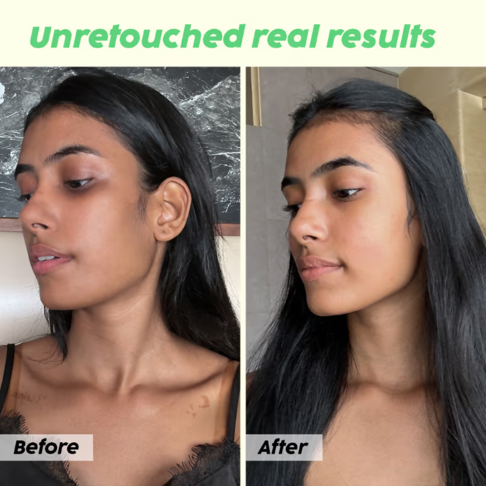 PLIX The Plant Fix Guava Glow Regime Combo | Grocsy