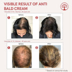 Ivory Natural Bald Cream For Hair For Stimulate Growth Of Hair, Avoid Thinning | Grocsy