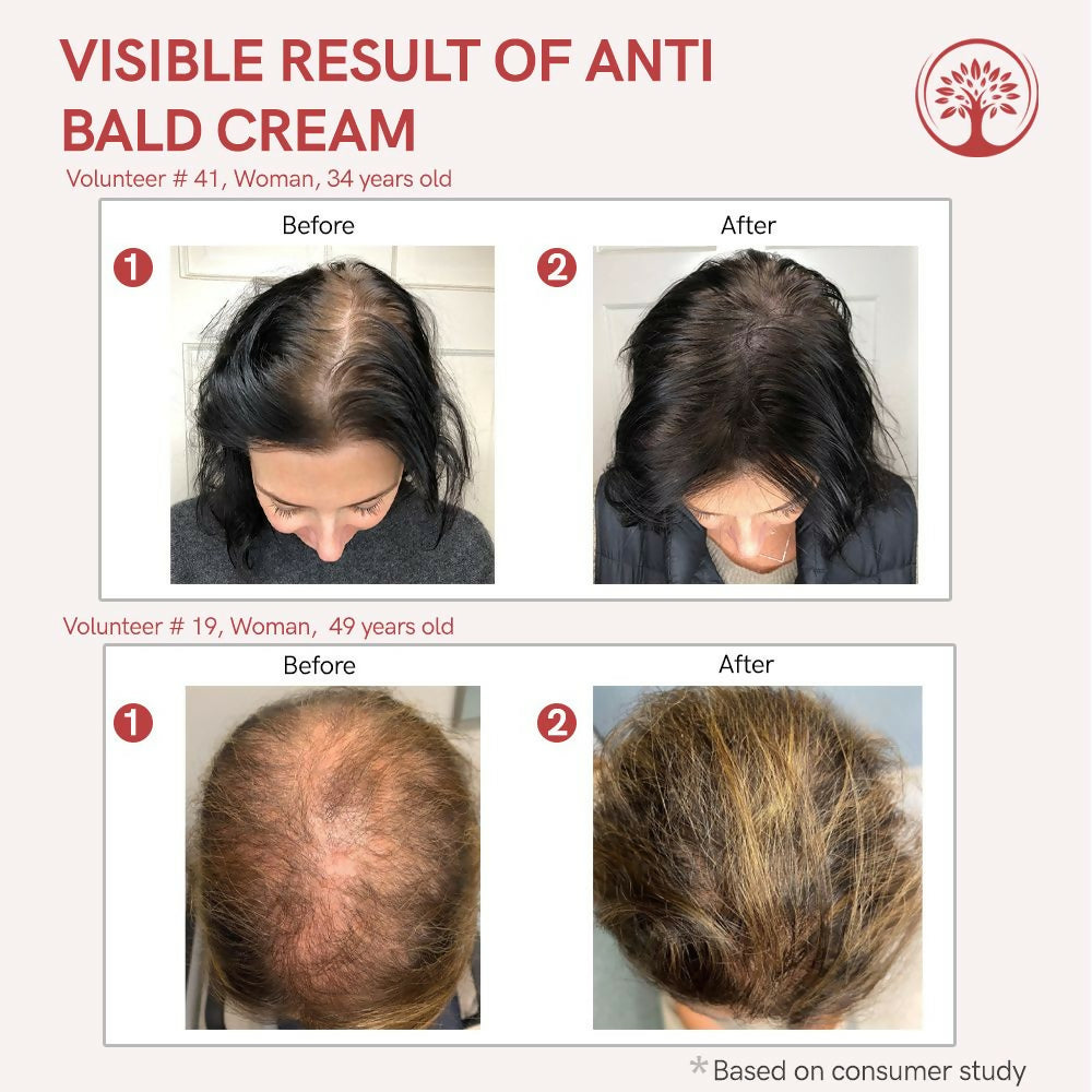 Ivory Natural Bald Cream For Hair For Stimulate Growth Of Hair, Avoid Thinning | Grocsy