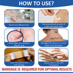 7 Days Natural Wart Remover Cream with AHA- BHA | Grocsy
