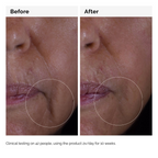 The Ordinary Growth Factors Solution 15% Serum | Grocsy