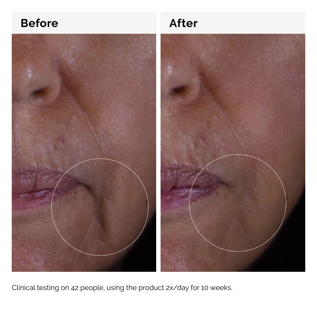 The Ordinary Growth Factors Solution 15% Serum | Grocsy