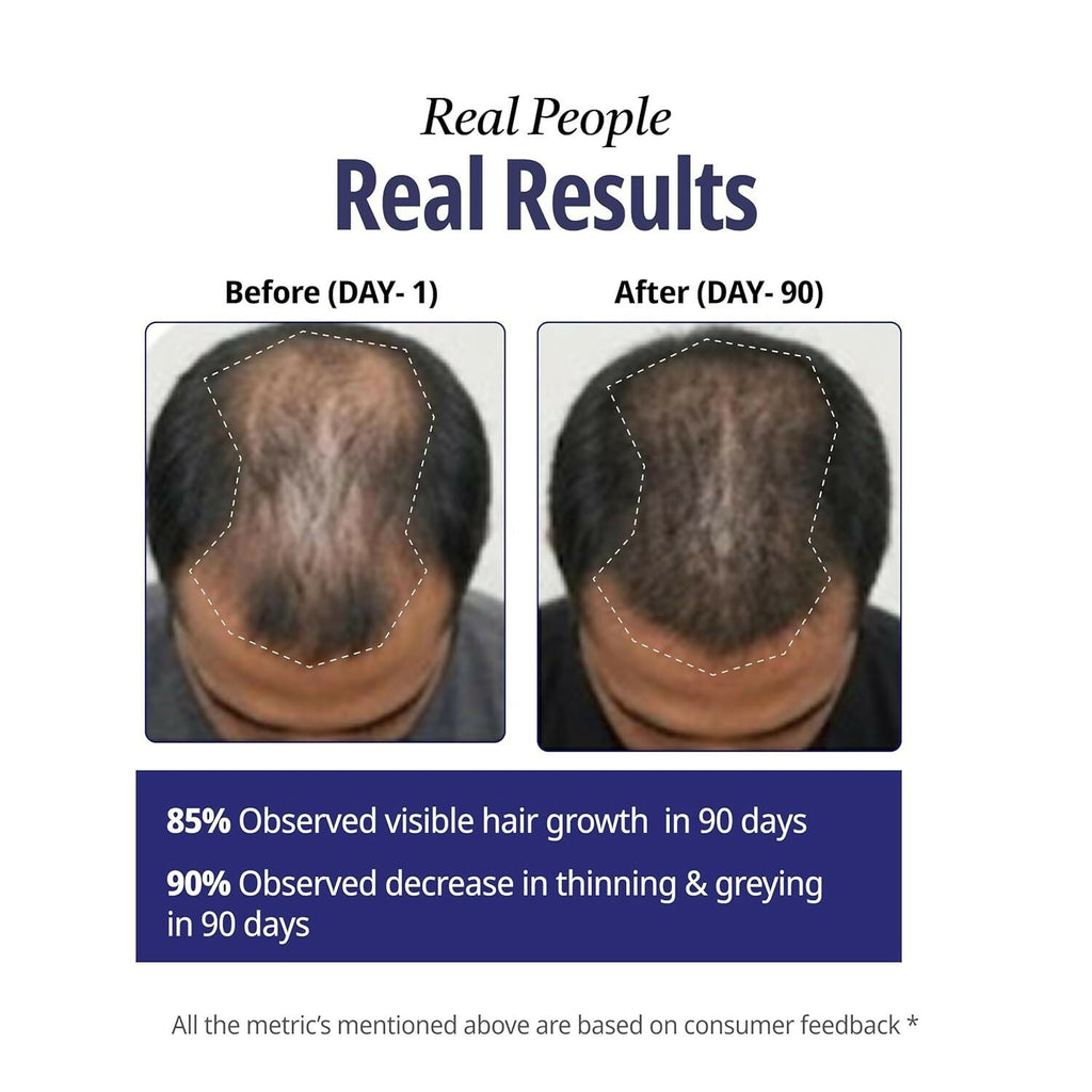 Reginald Men Athena- All in one Hair Serum | Grocsy