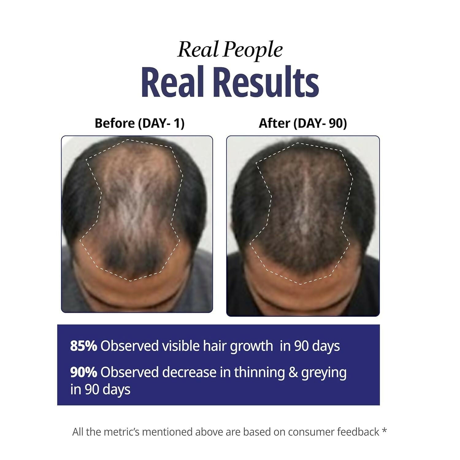Reginald Men Athena- All in one Hair Serum | Grocsy