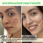 PLIX The Plant Fix Underarm Depigmentation Serum Spray & 2% Alpha Arbutin Face Serum | Grocsy