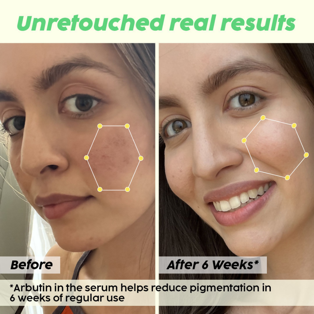 PLIX The Plant Fix Underarm Depigmentation Serum Spray & 2% Alpha Arbutin Face Serum | Grocsy