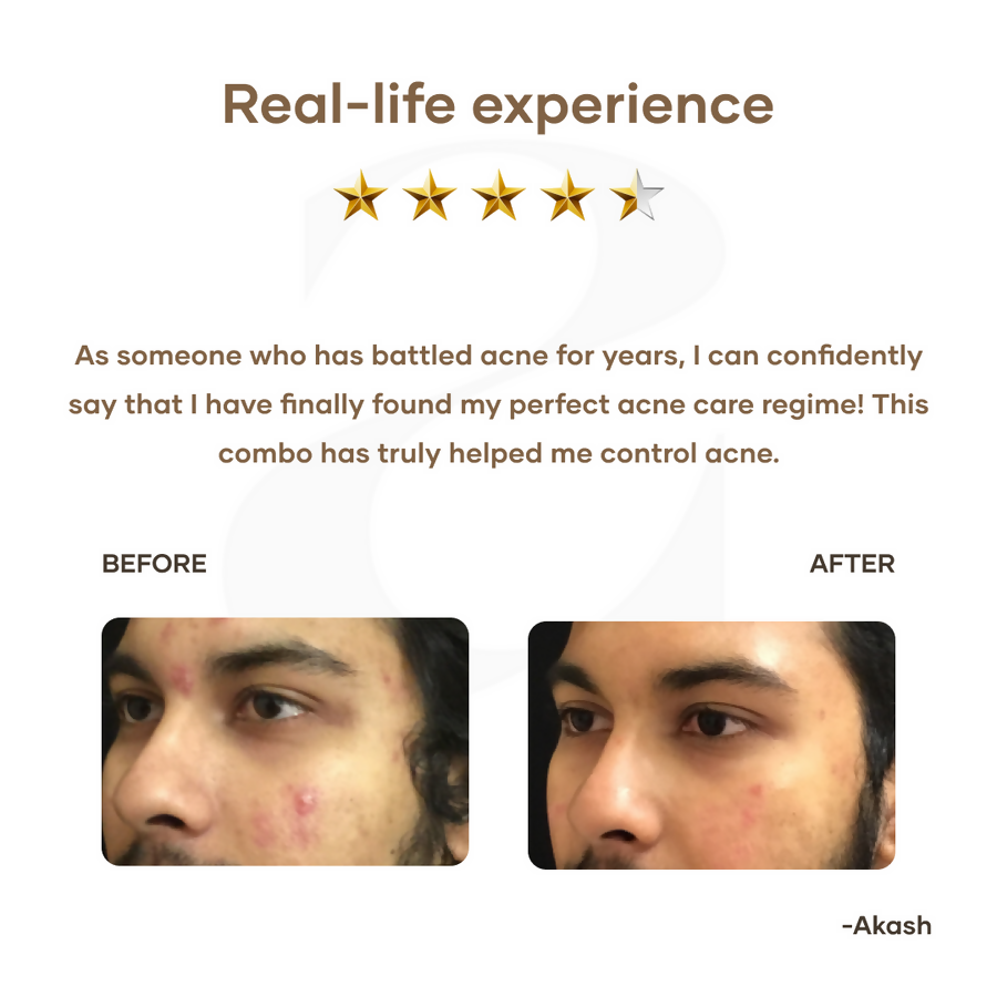 Mars By GHC Mars Ultimate Acne Care Regime Combo | Grocsy