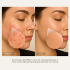 Seoulskin Snail Mucin Micro-needling Serum 7500 PPM | Grocsy