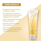 Ozone Acne Check Face Wash | Grocsy